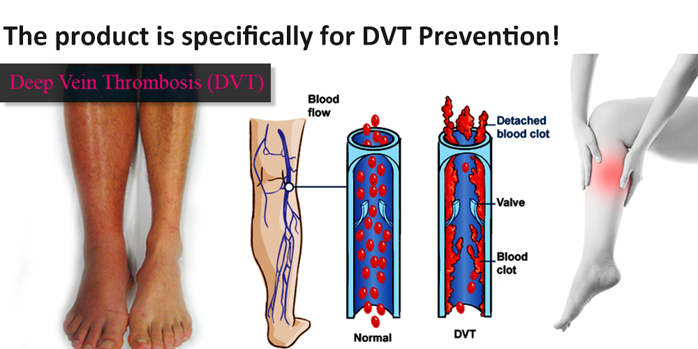 scd compression sleeves