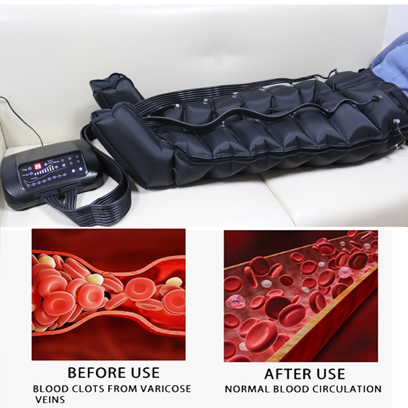 lymphatic drainage at home for legs